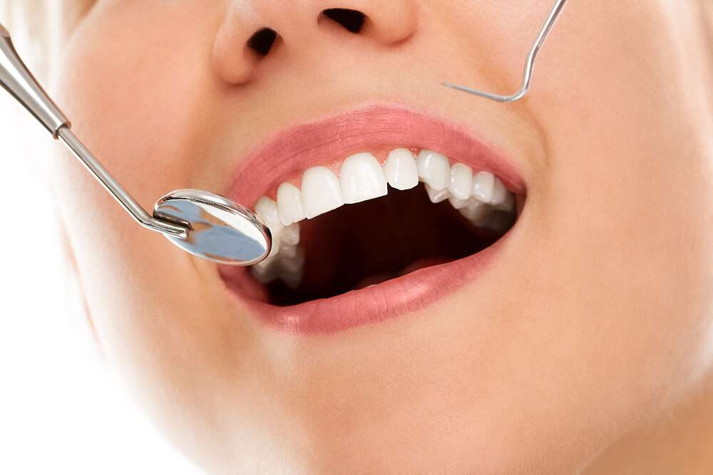 طرح لبخند چیست؟